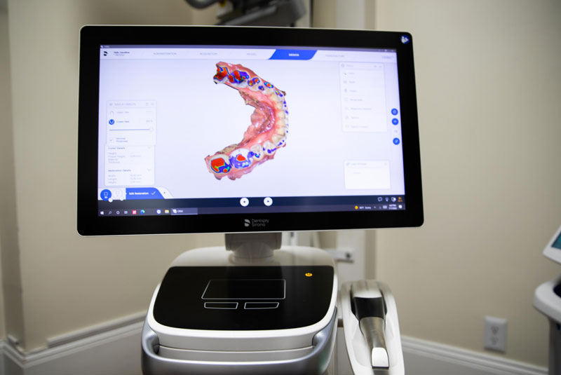 cerec machine being used to make implants