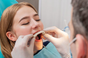 a patient getting full mouth dental implants placed that can benefit her oral function and health.