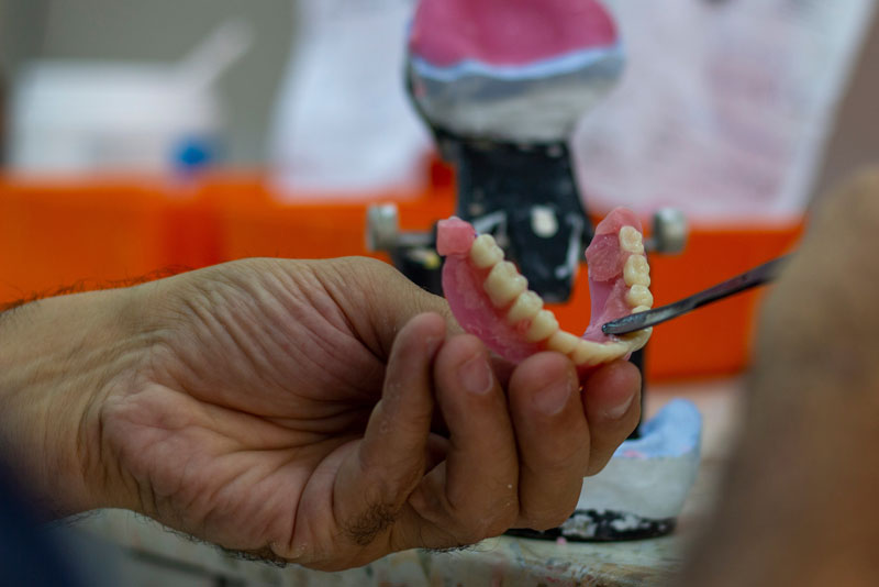 a dental professional working on implant supported dentures.
